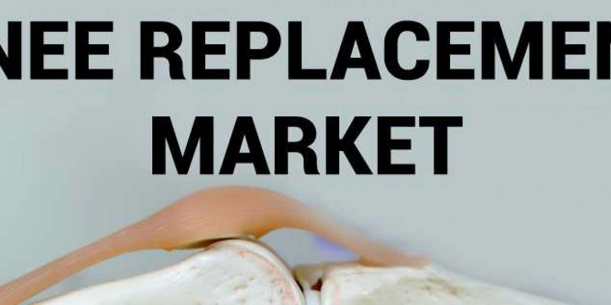 Knee Replacement Market, by Demand Analysis, Regions, Risk Analysis, Driving Forces and Application, Forecast to 2027.