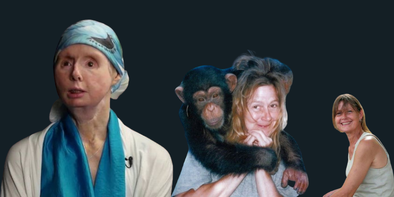 Charla Nash: A survival of animal attacks lost her face