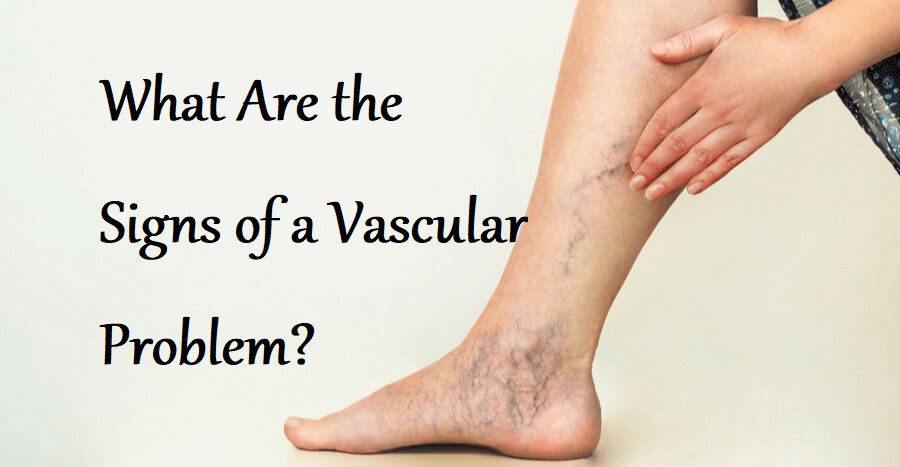 What Are the Signs of a Vascular Problem?