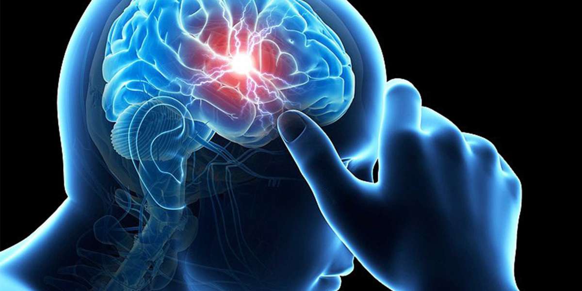 Global Head Trauma Market to Capture a CAGR of 7.2% during 2022-2030; Asserts MRFR