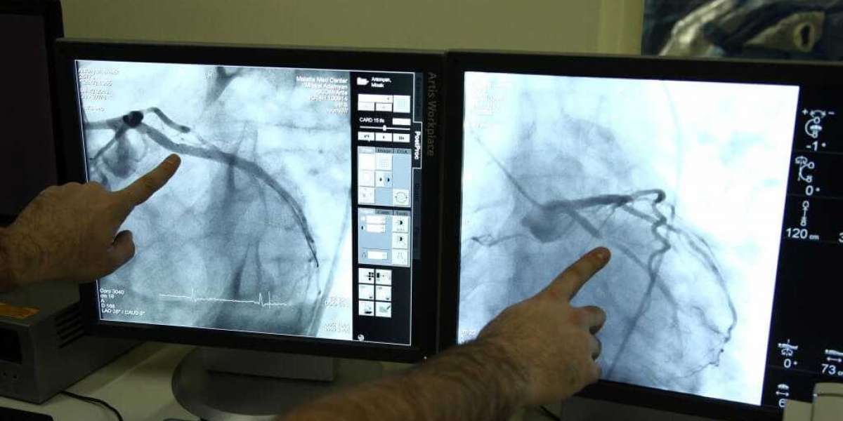 North America Dominates Global Coronary Angiography Devices Market Size; MRFR Reveals Overview for 2022-2030