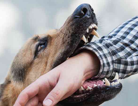 Get A Help From San Diego Dog Bite Lawyer Today