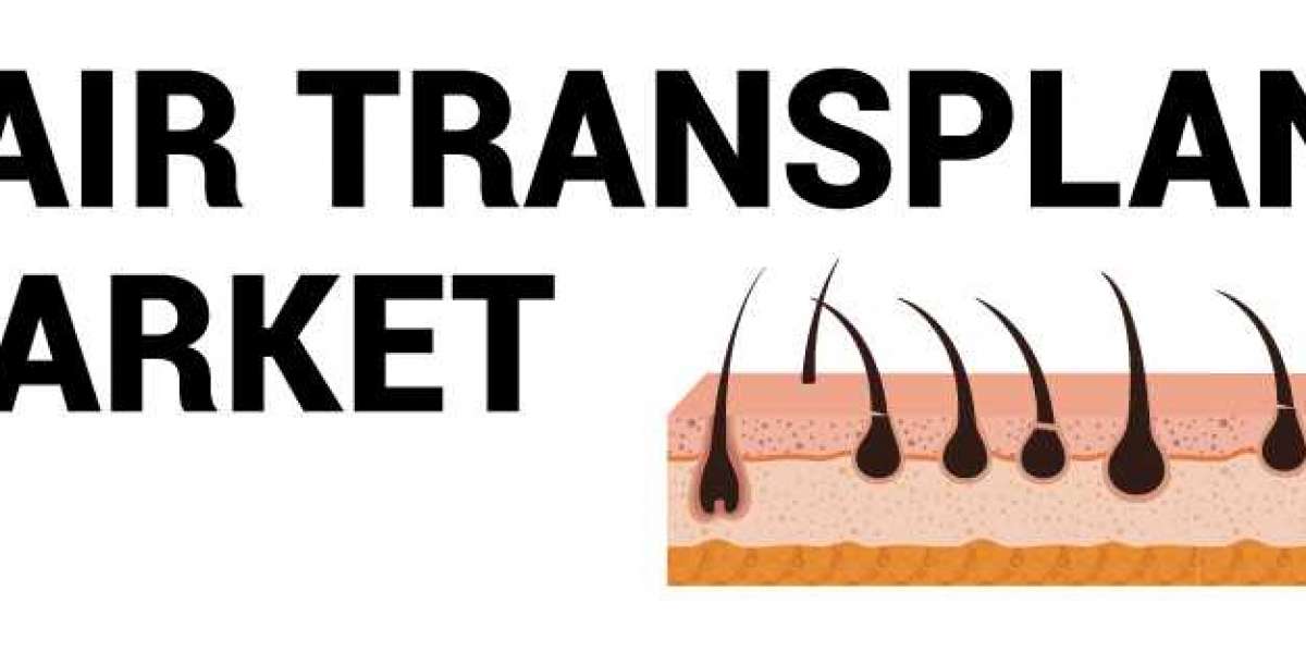 Hair Transplant Market Share, Globe Key Updates, Demand, Size, and Industry Forecast 2023-2028