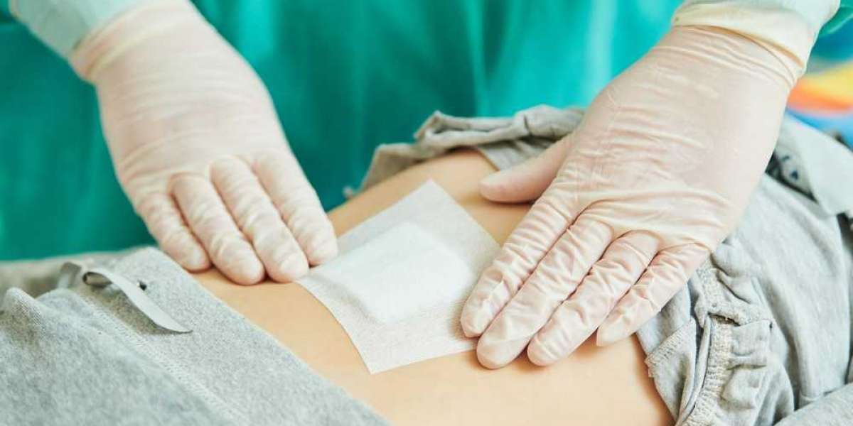 Chronic Wound Care Market Size, Cost Structure and Prominent Key Players Analysis and Forecast: 2023-2033