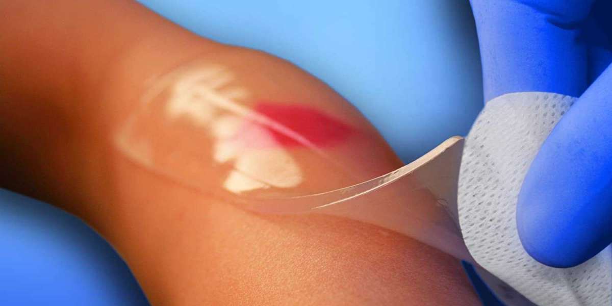Oral Hydrogel Wound Dressing Market Trends, Size, Research, Global Share and Growth Factor and Forecast: 2023-2033