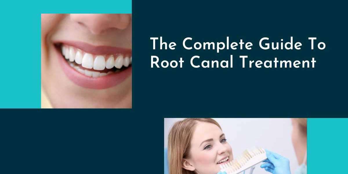 The Complete Guide To Root Canal Treatment