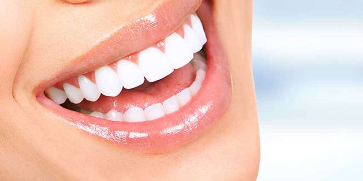 The Main Benefits of Laser Teeth Whitening