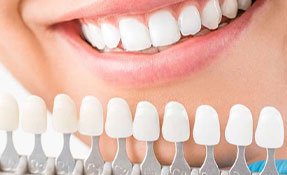 Understanding Cosmetic Dentistry in Scottsdale: BenefitsTreatments and More | Pearltrees