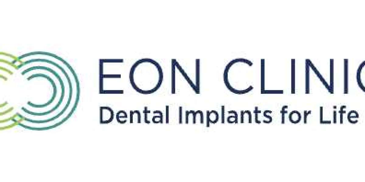 Can Dental Implants Be Done Same Day?