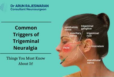 The common triggers of trigeminal neuralgia treatment and how to avoid surgery