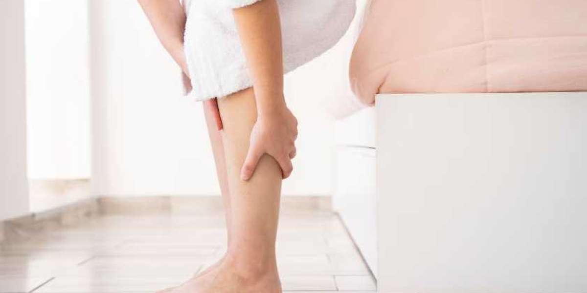 What Causes Varicose Veins in Women?