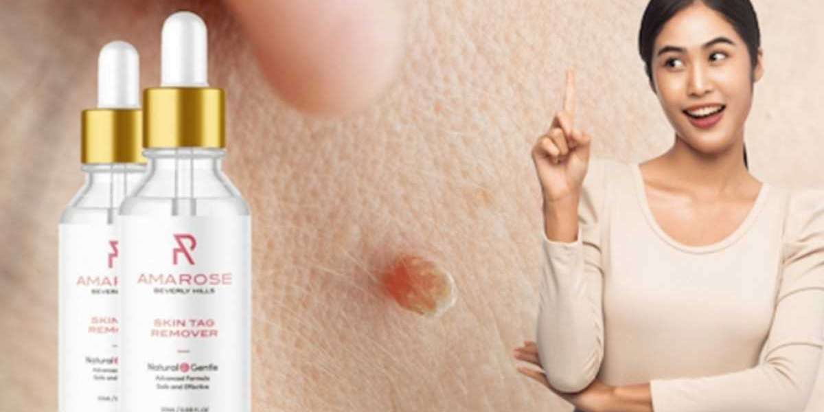 10 Perfect Skin Tag Remover Canada