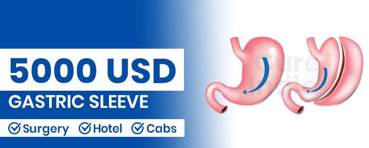 Comparing the cost of a gastric sleeve surgery  – Cure India
