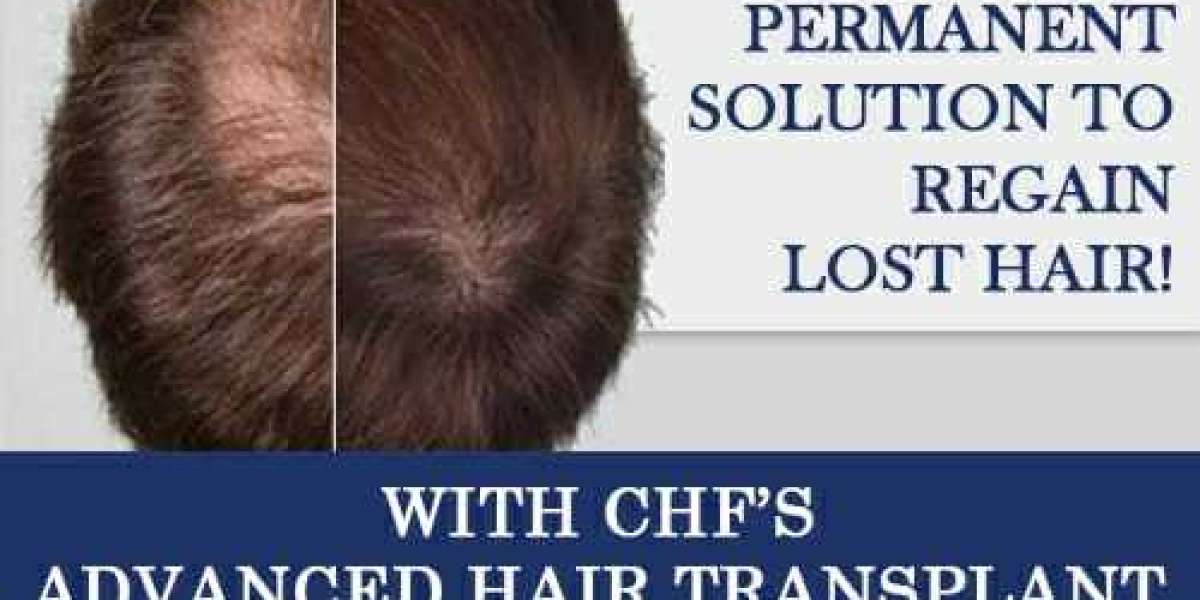 What does happen lifer after hair transplant