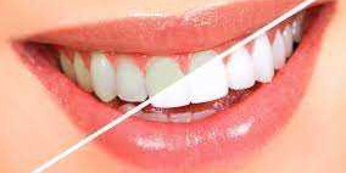 The Importance Of Keeping Your Teeth Clean