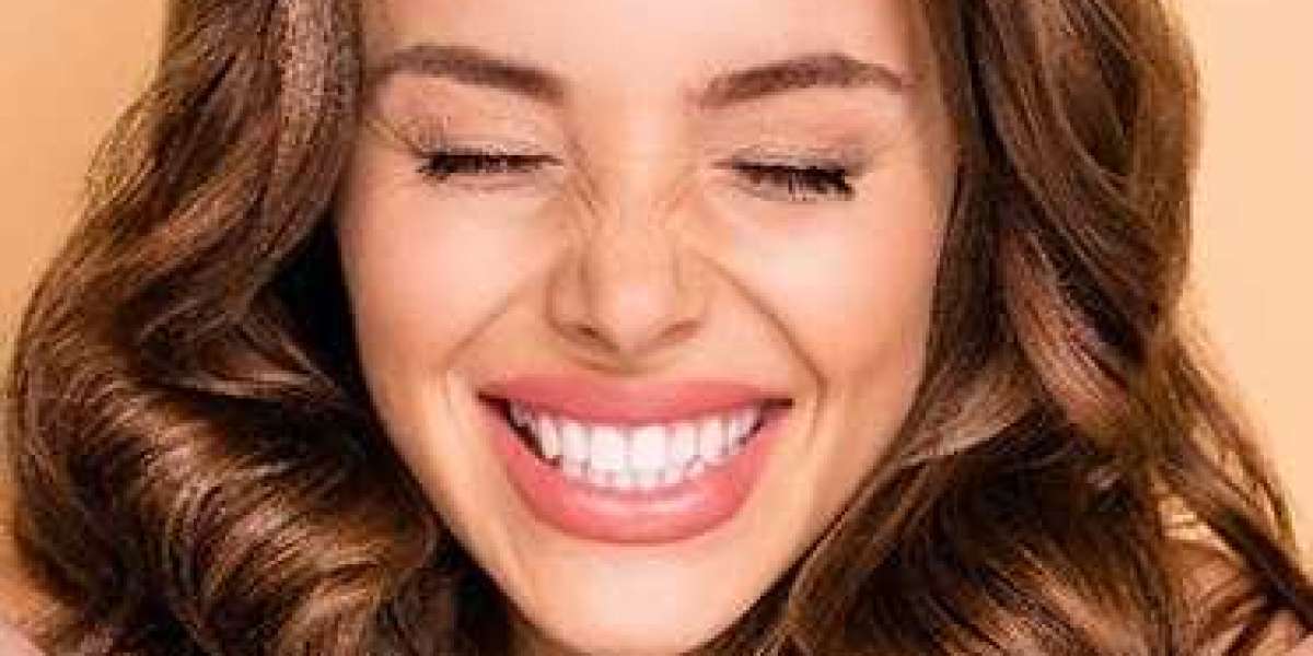 Things That You Should Know About Dental Veneers
