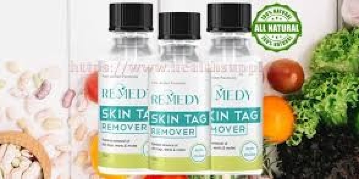 15 Best Remedy Skin Tag Remover Bloggers You Need to Follow