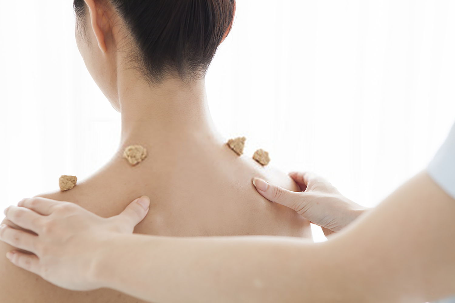 Moxibustion and Acupuncture for Stress Relief in Tao Acupuncture - AtoAllinks