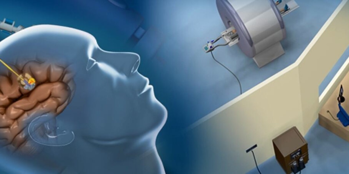 A Comprehensive Epilepsy Surgery Market Report Covers Industry Revenue Scope and CAGR Values