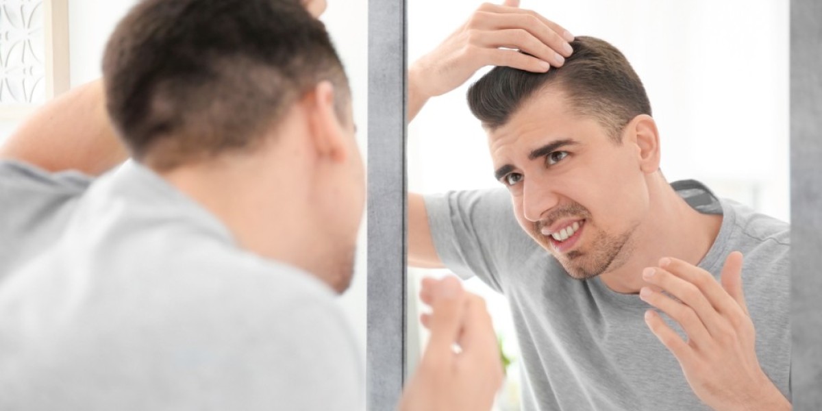  Transform Your Hair, Transform Your Life: Expert Hair Loss Treatment
