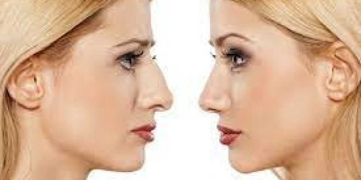 Rhinoplasty Recovery Time Day By Day