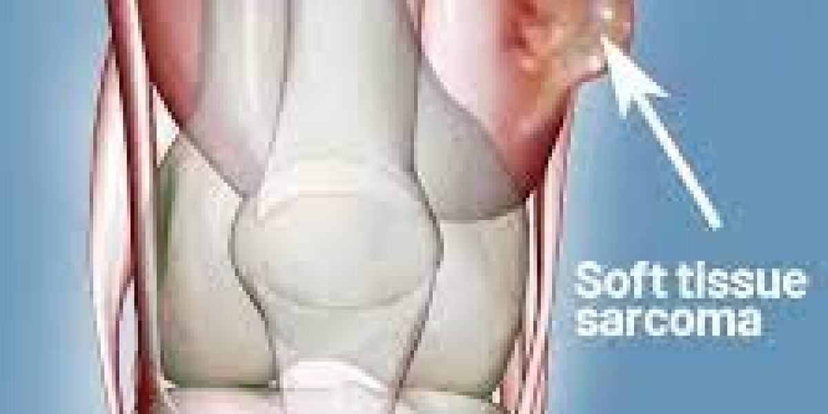 Soft Tissue Sarcoma Market Size 2023: Epidemiology, Industry Trends and Forecast by 2033