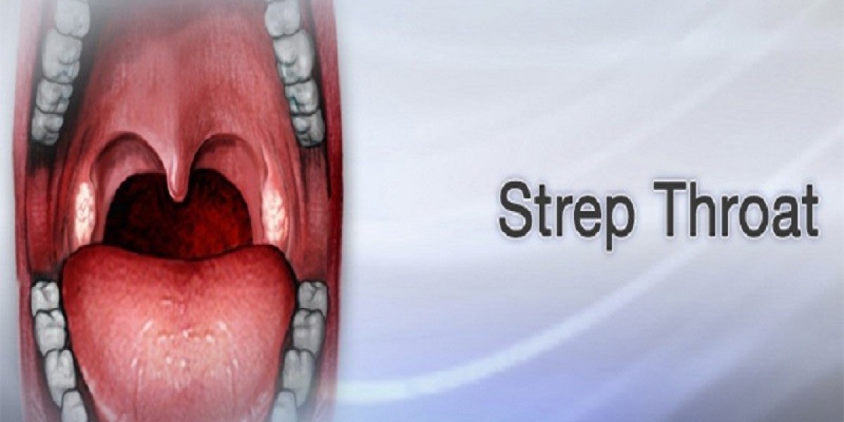 Exploring the Possibility of Strep Throat Without Tonsils