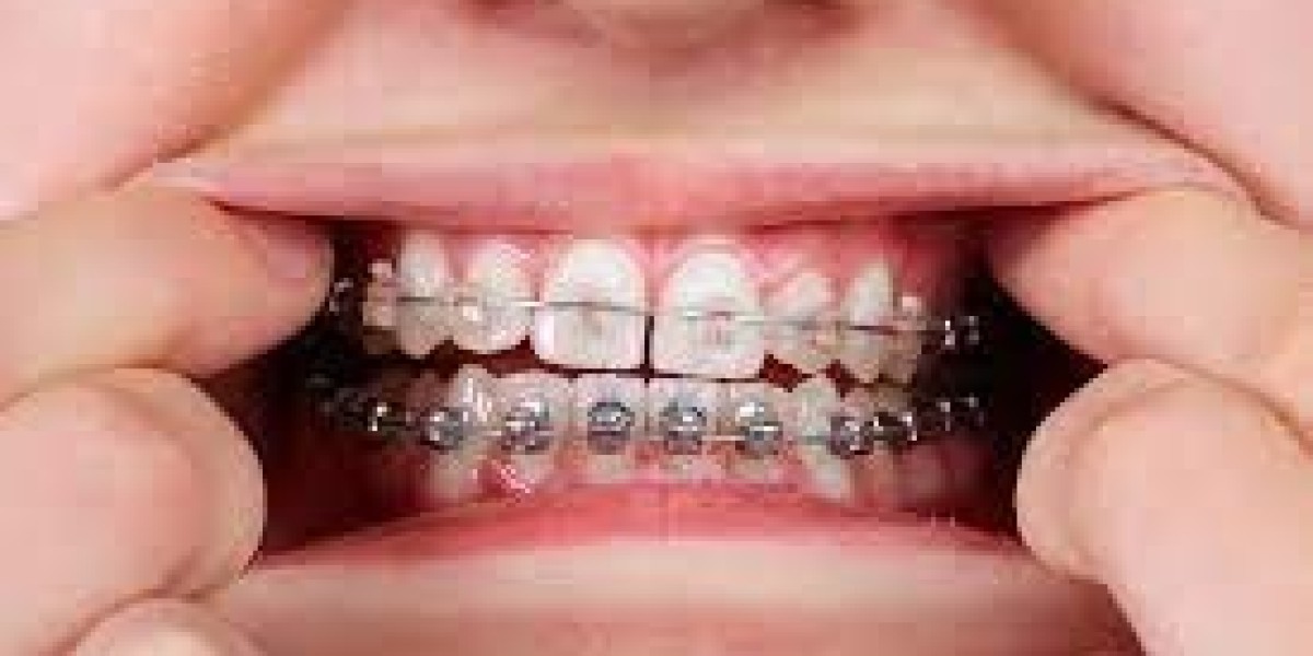 Revolutionizing Facial Harmony: Dentofacial Orthopedics in Action