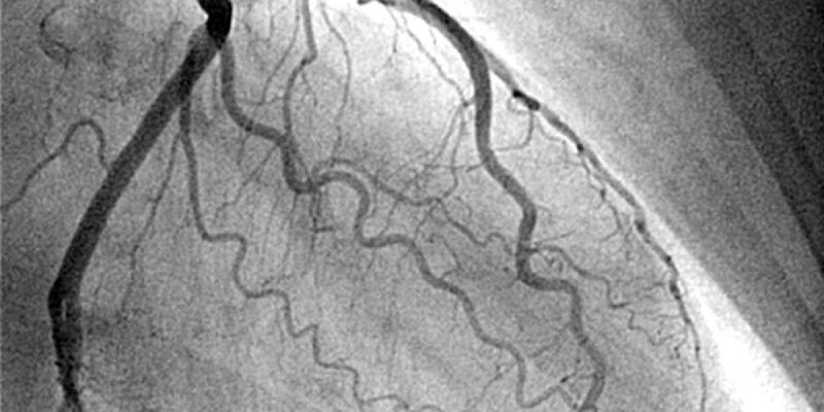 WHAT IS ANGIOGRAPHY AND IS IT A RISKY PROCEDURE?