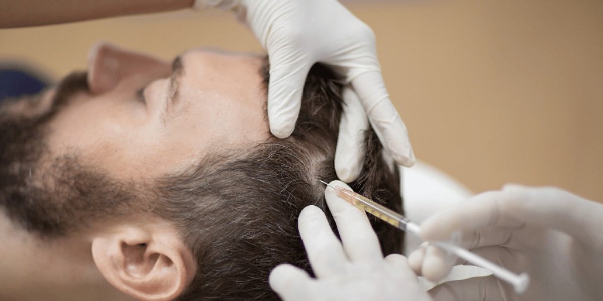 Replenish Your Hair's Vitality with PRP Therapy