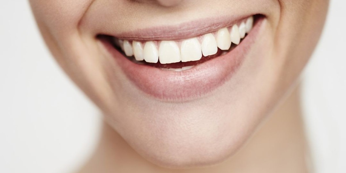 Dental Implants for a Youthful Smile: Preventing Facial Sagging