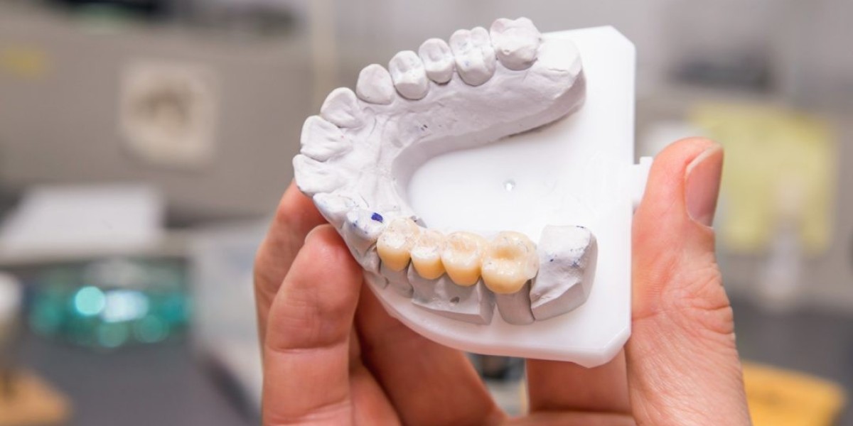 The Esthetic Bridge Makeover: Redesigning Your Smile