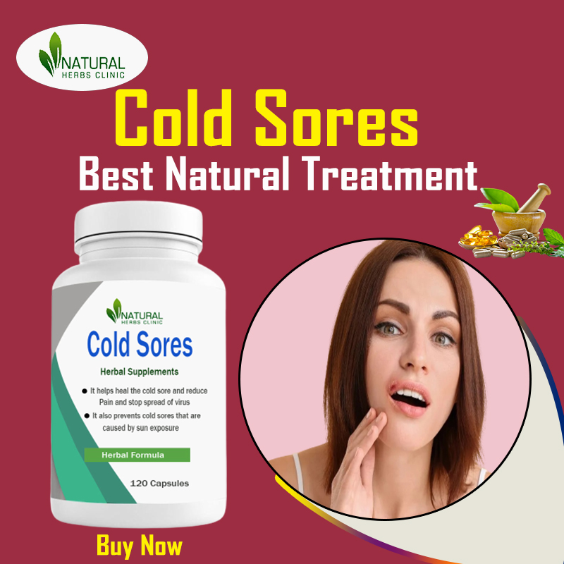 Natural Remedies for Cold Sores to Reduce Duration and Time