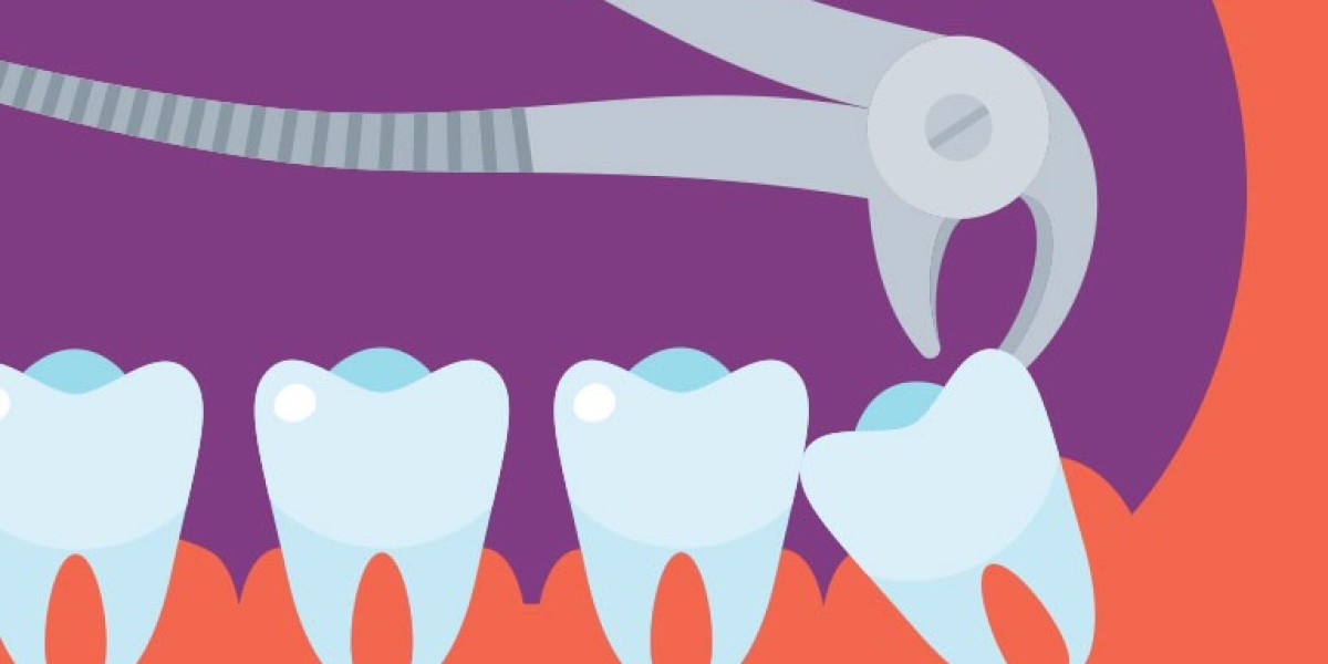 From Wisdom to Relief: The Tooth Extraction Process