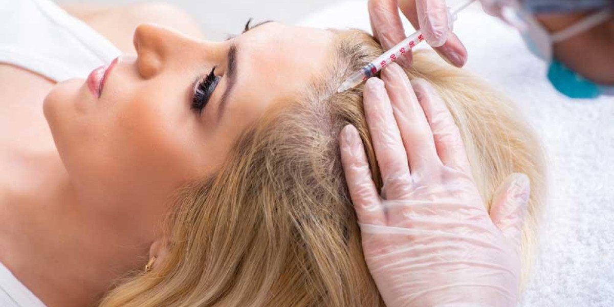حل دبي المتطور لتساقط الشعر: علاج PRP
