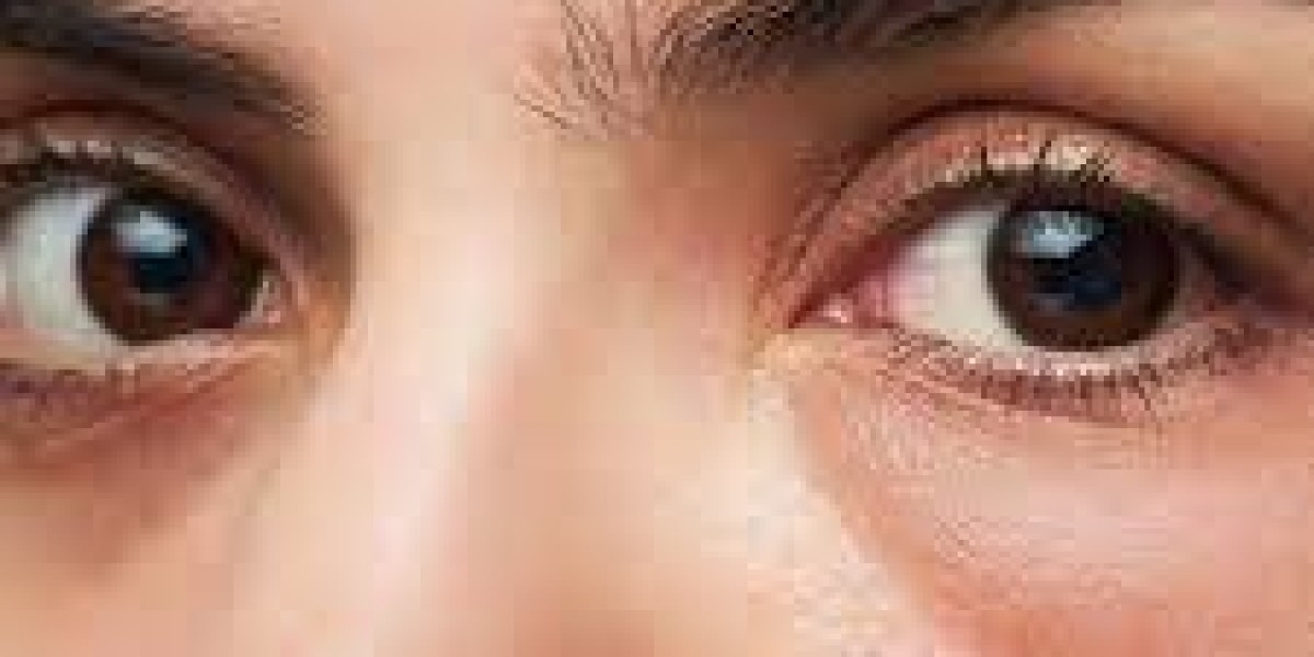 Eye Bag Surgery: Benefits, Risks, Recovery Time & Cost in Delhi