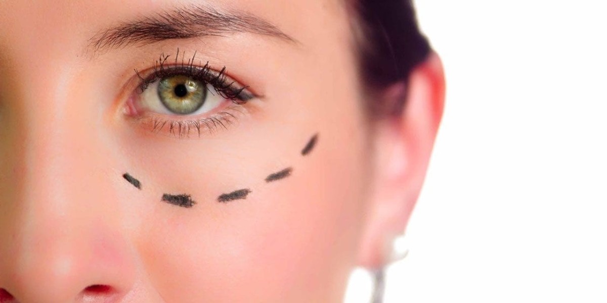 Mastering the Art of Facial Rejuvenation: Brow Lift Surgery Explored