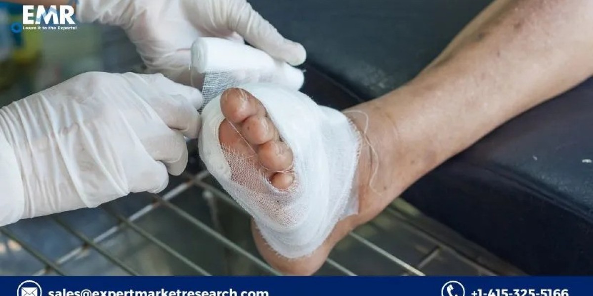 Diabetic Ulcer Treatment Market to be Driven by the Increasing Prevalence of Diabetes in the Forecast Period of 2023-203