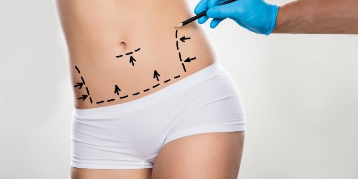Achieve a Flatter Stomach with Tummy Tuck Surgery