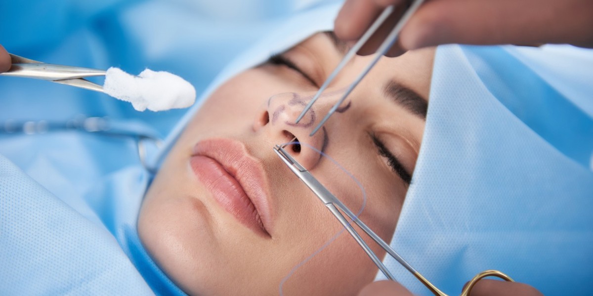Reshaping Possibilities: Your Guide to Modern Rhinoplasty