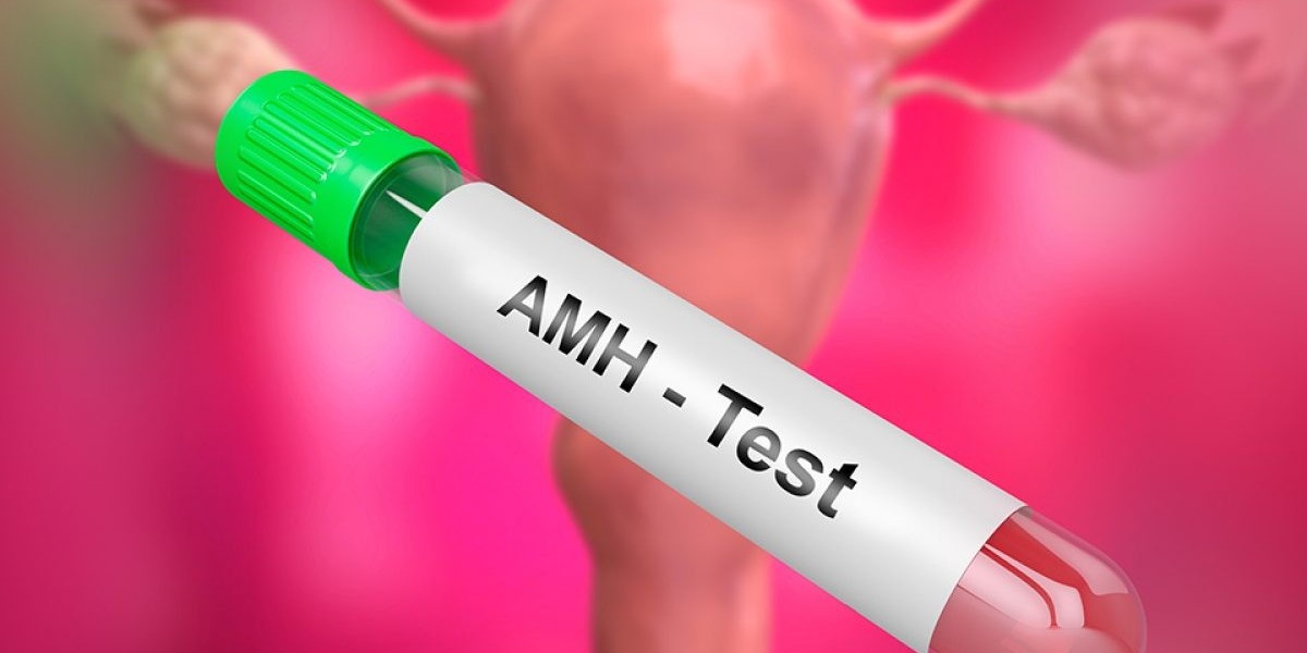 Who requires an AMH test?
