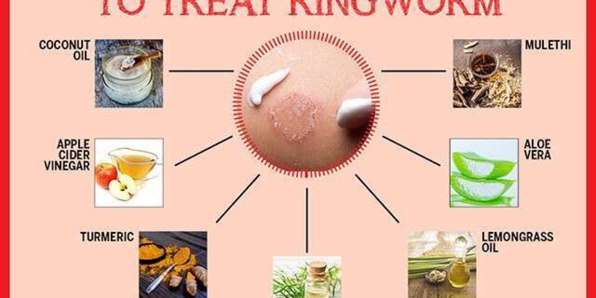 Ringworm Treatment Market Size, Share, Growth and Analysis 2022 Forecast to 2032.