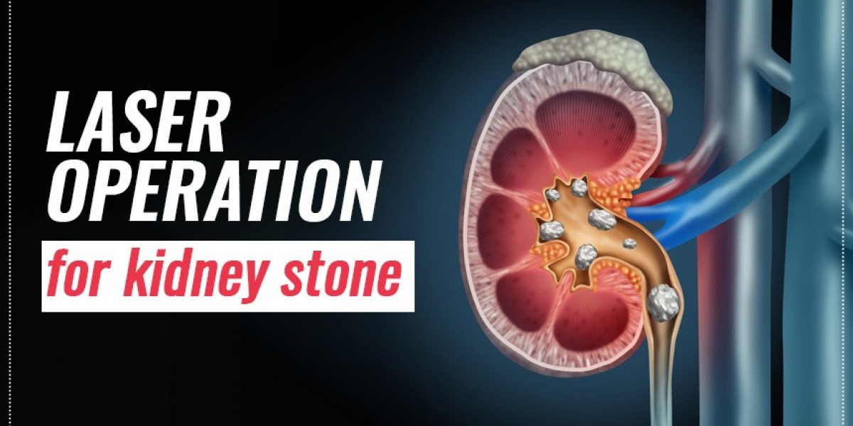 Why you should opt for Laser Operation for Kidney Stone?