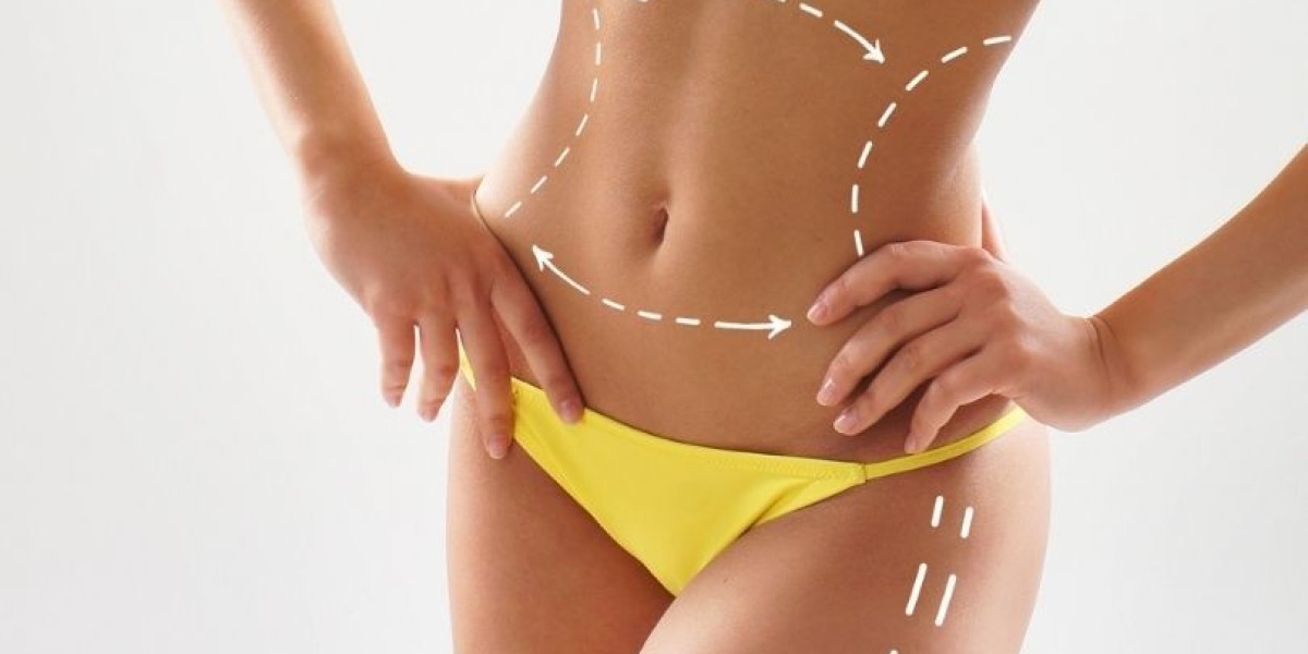 How Liposuction Can Enhance Your Figure