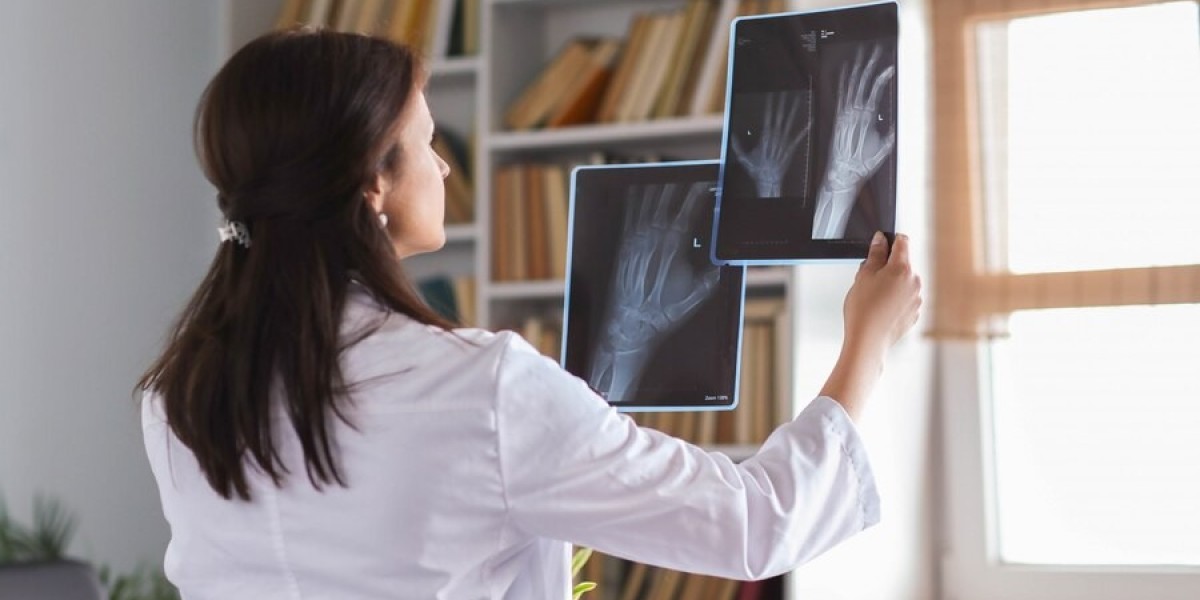 When and Why You Might Need Mobile X-ray Services?