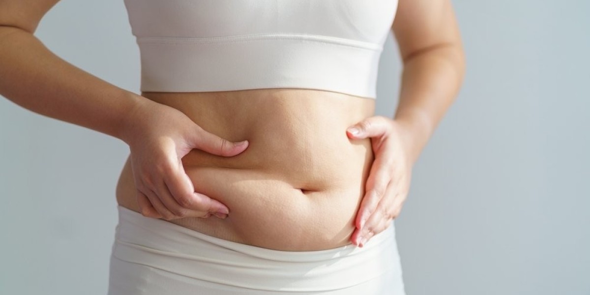 Sculpted Perfection with CoolSculpting