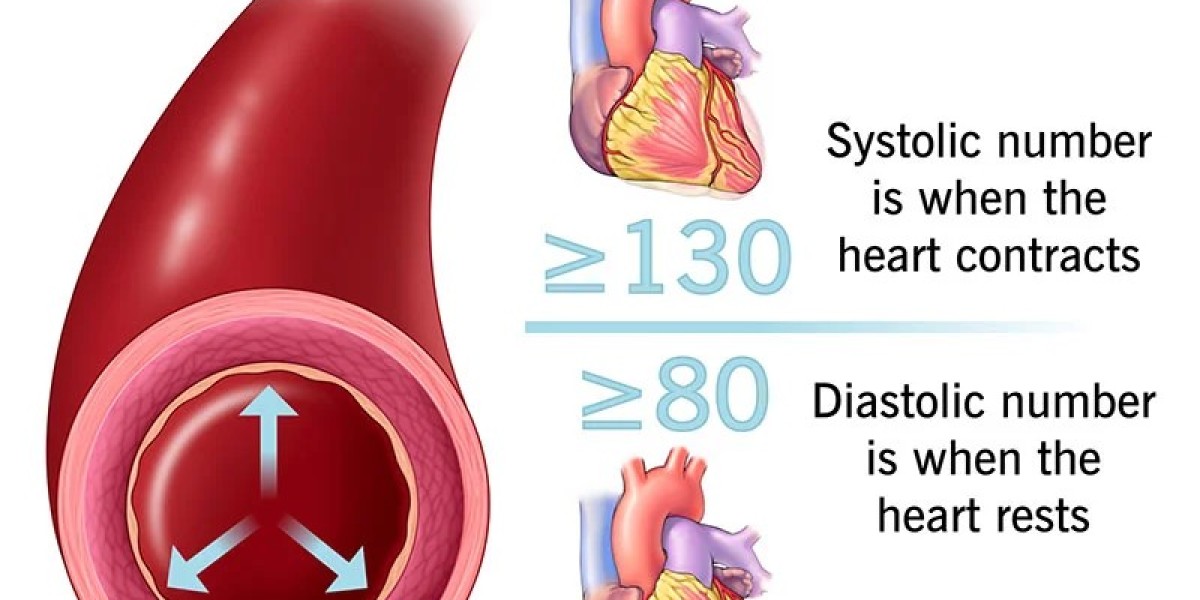 Understanding High Blood Pressure Symptoms