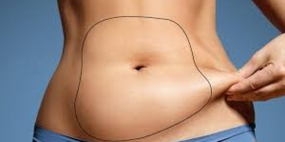 Liposuction: The Ultimate Body Contouring Solution