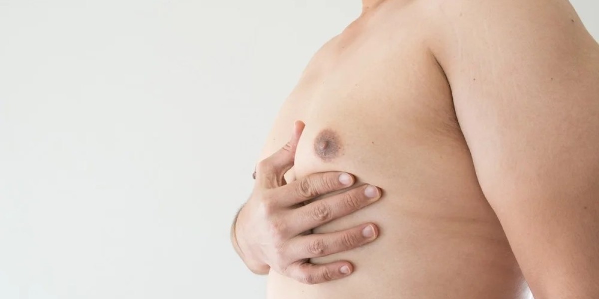  Hormonal Changes and Gynecomastia: What to Expect