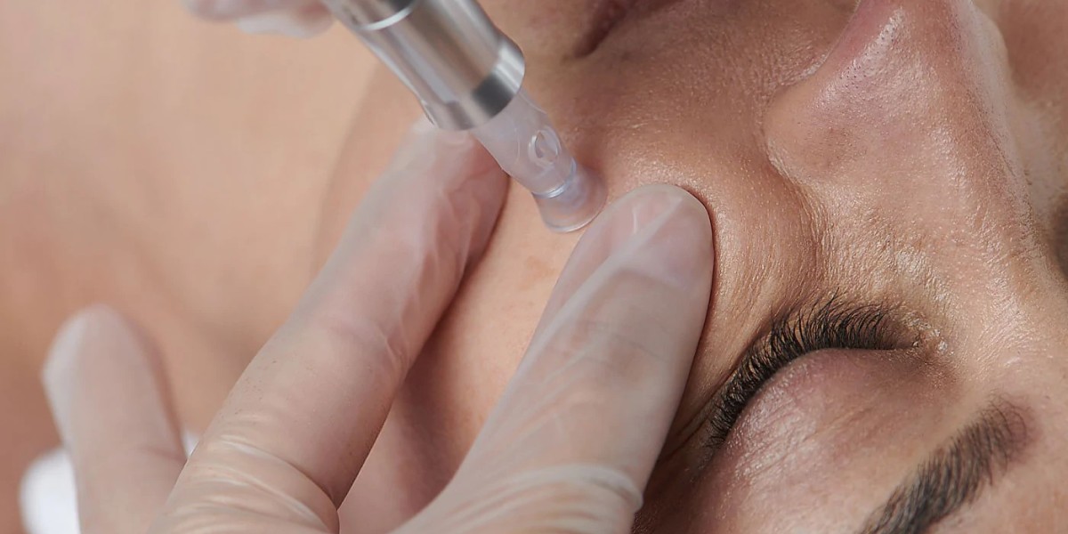 The Science Behind Mesotherapy: Understanding the Injection Process